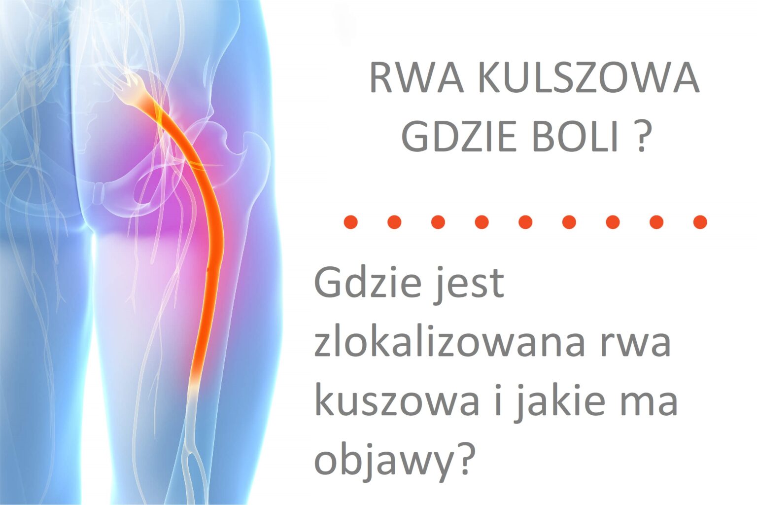 Tabletki na rwę kulszową Jakie leki pomagają na rwę