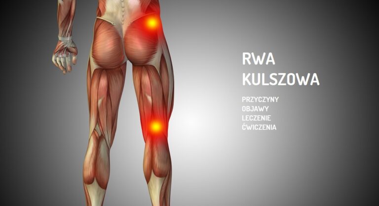 Rwa Kulszowa Objawy Leczenie Przyczyny Poradnik 7229