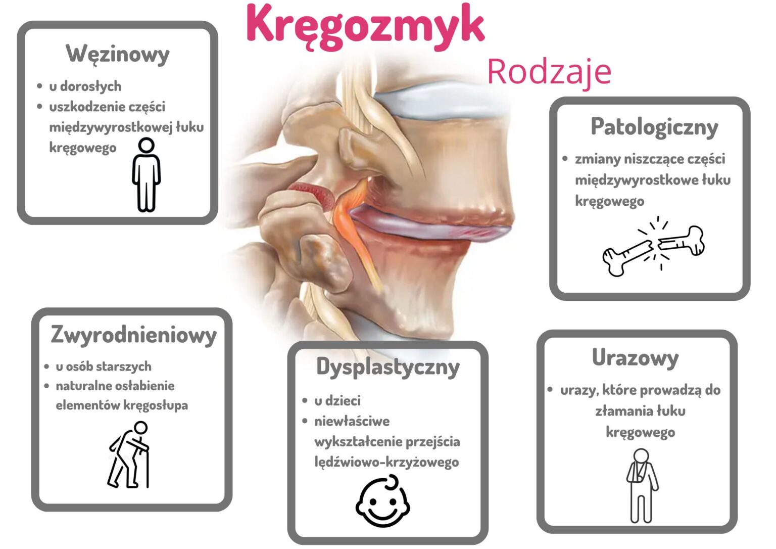 Wymień Objawy Nagłego Zatrzymania Krążenia Kręgozmyk - czy jest niebezpieczny? - 4 SPOSOBY LECZENIA