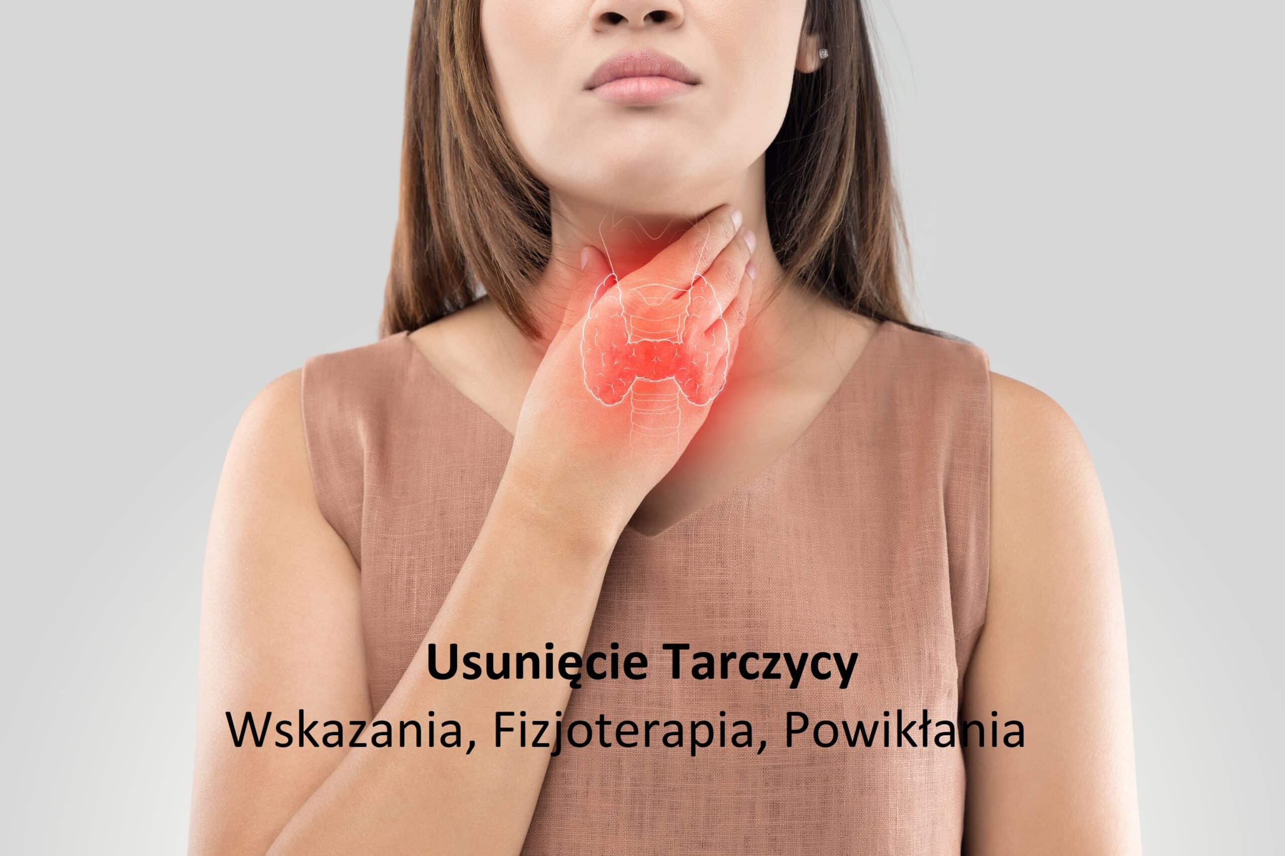 Usunięcie tarczycy – tyroidektomia