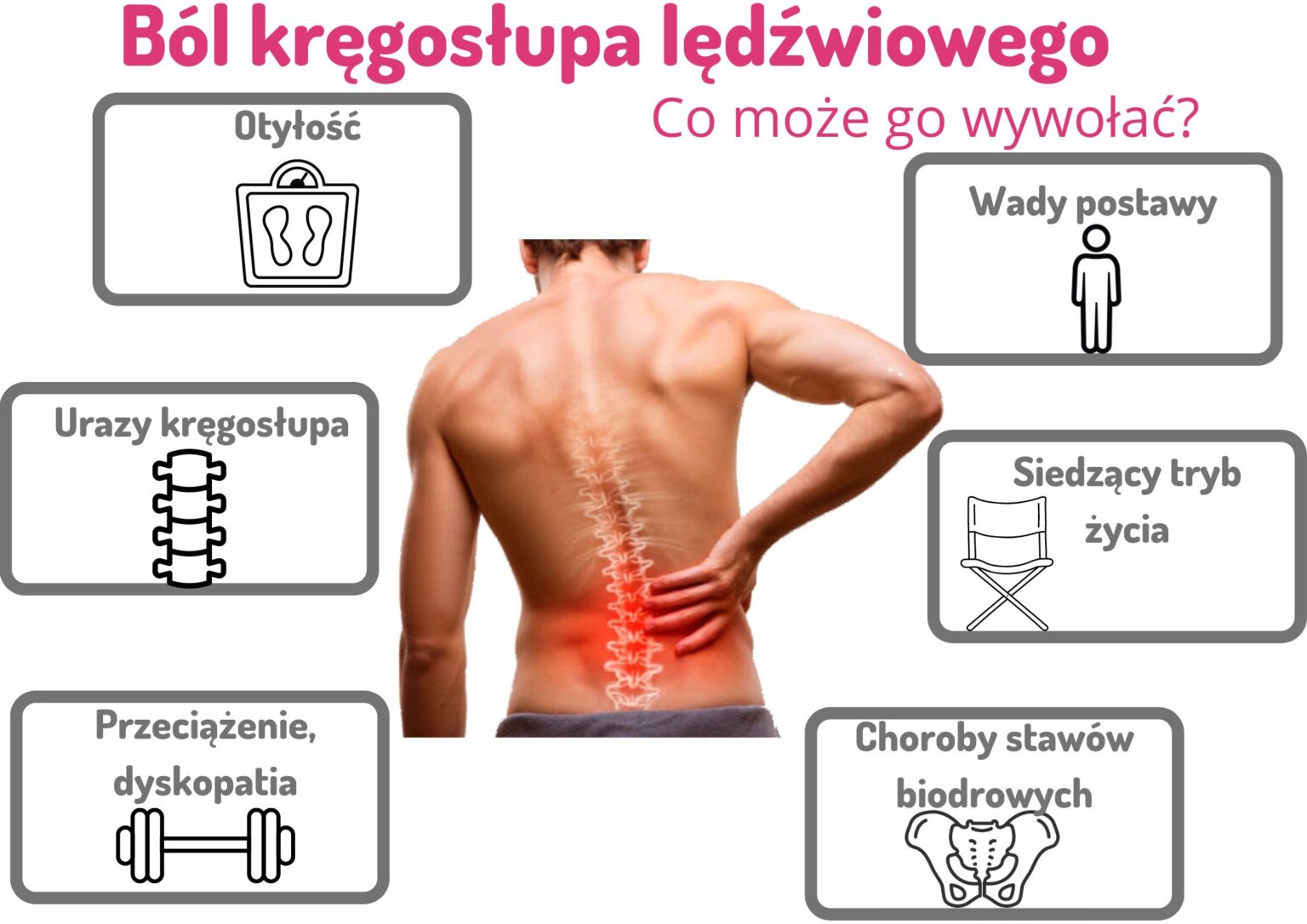 Ból Kręgosłupa Lędźwiowego Poradnik 2023 4 Sposoby 2381