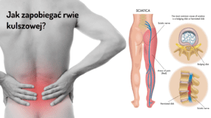 jak zapobiegać rwie kulszowej